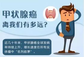 健康科普-甲状腺癌喜欢盯上哪几类人群？-图2